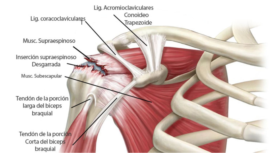 Qu Es El Manguito De Rotadores Fisioterapia Granada Qu Es El Manguito De Rotadores Fisioterapia Granada